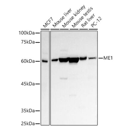 Western Blot - Anti-ME1 Antibody (A14493) - Antibodies.com