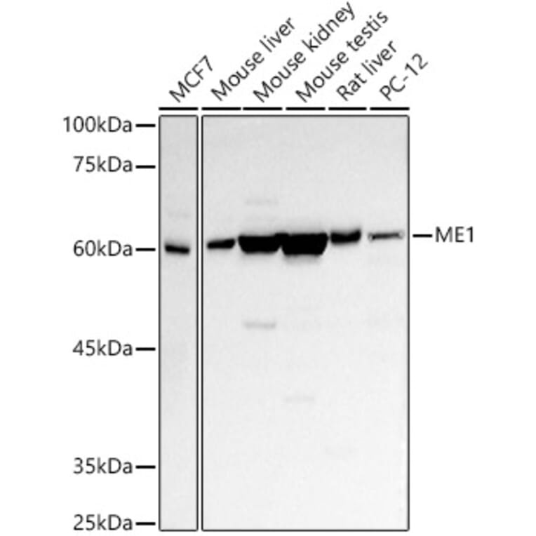Western Blot - Anti-ME1 Antibody (A14493) - Antibodies.com