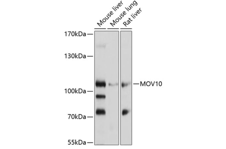 Western Blot - Anti-Mov10 Antibody (A14495) - Antibodies.com