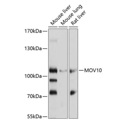 Western Blot - Anti-Mov10 Antibody (A14495) - Antibodies.com