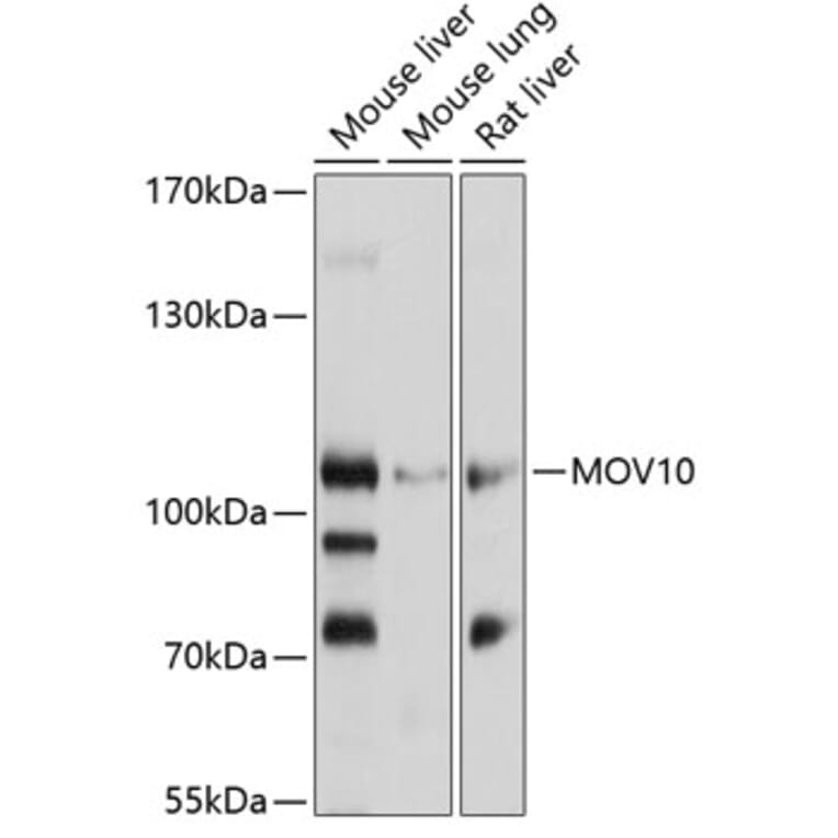 Western Blot - Anti-Mov10 Antibody (A14495) - Antibodies.com