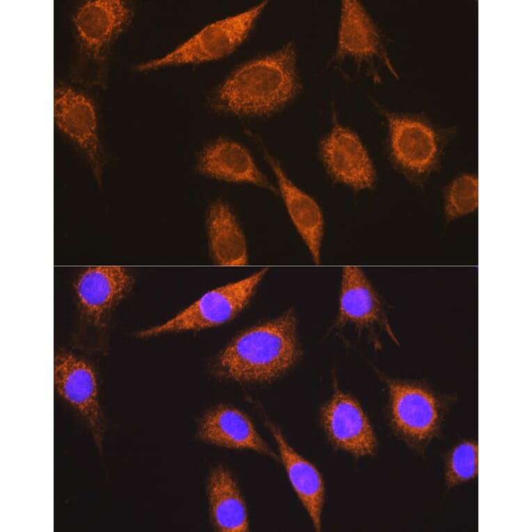 Immunofluorescence - Anti-Methylmalonyl Coenzyme A mutase Antibody (A14496) - Antibodies.com