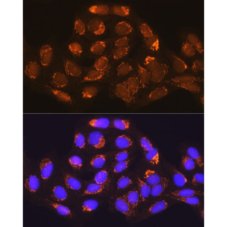 Immunofluorescence - Anti-Methylmalonyl Coenzyme A mutase Antibody (A14496) - Antibodies.com