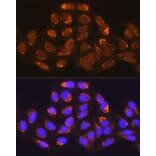 Immunofluorescence - Anti-Methylmalonyl Coenzyme A mutase Antibody (A14496) - Antibodies.com