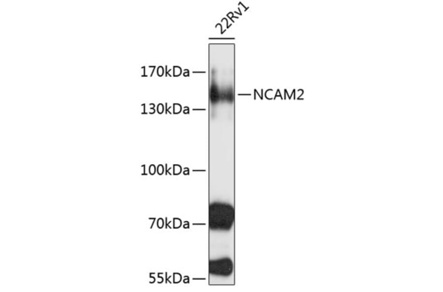 Western Blot - Anti-NCAM2 Antibody (A3973) - Antibodies.com