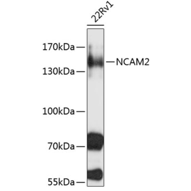 Western Blot - Anti-NCAM2 Antibody (A3973) - Antibodies.com