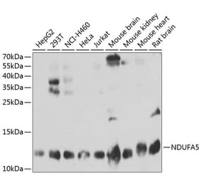 Western Blot - Anti-NDUFA5 Antibody (A3976) - Antibodies.com
