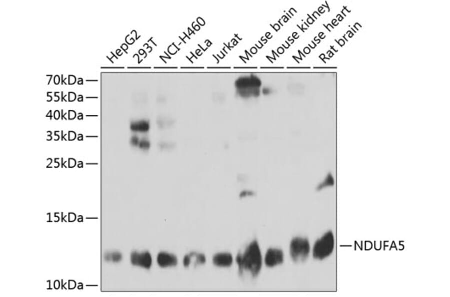 Western Blot - Anti-NDUFA5 Antibody (A3976) - Antibodies.com