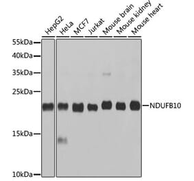Western Blot - Anti-NDUFB10 Antibody (A14499) - Antibodies.com