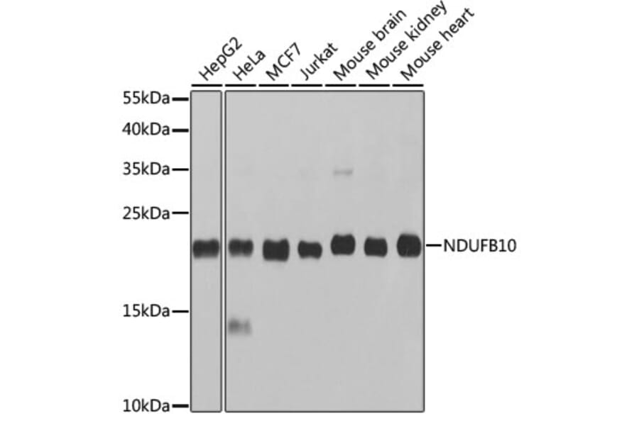 Western Blot - Anti-NDUFB10 Antibody (A14499) - Antibodies.com