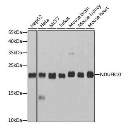 Western Blot - Anti-NDUFB10 Antibody (A14499) - Antibodies.com