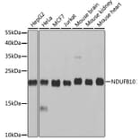 Western Blot - Anti-NDUFB10 Antibody (A14499) - Antibodies.com