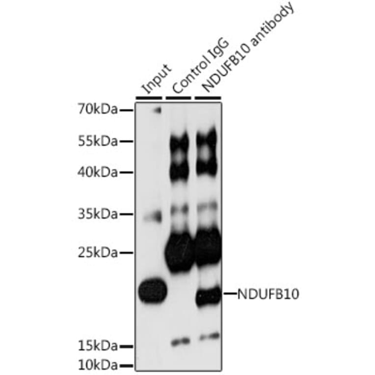 Western Blot - Anti-NDUFB10 Antibody (A14499) - Antibodies.com