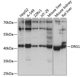 Western Blot - Anti-DRG1 Antibody (A14500) - Antibodies.com