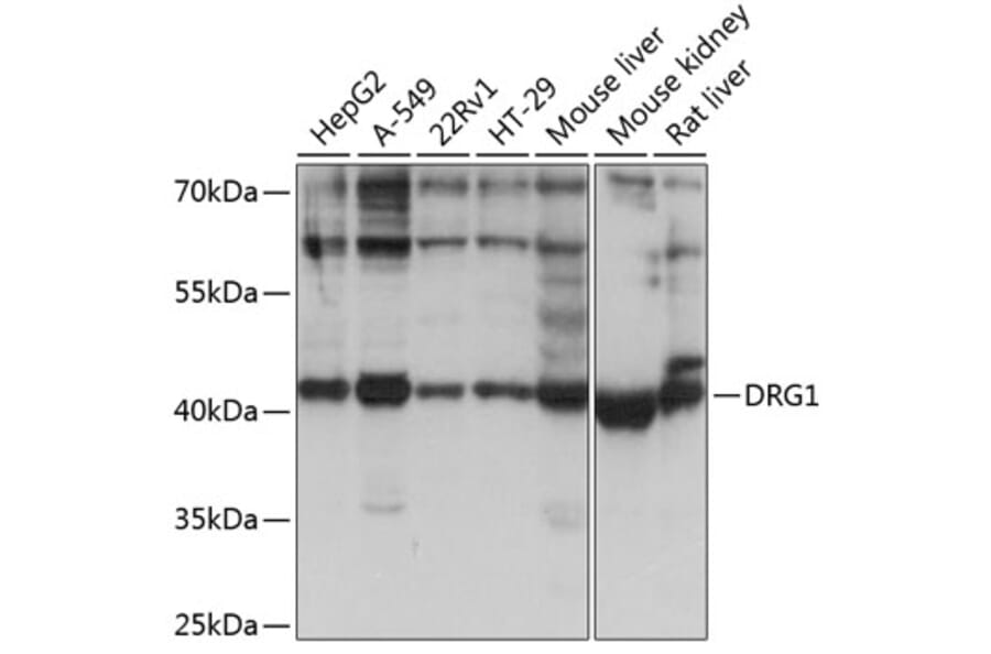Western Blot - Anti-DRG1 Antibody (A14500) - Antibodies.com