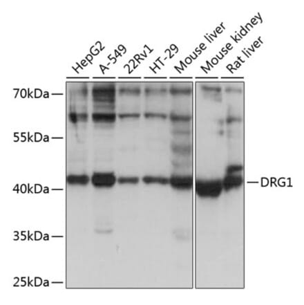 Western Blot - Anti-DRG1 Antibody (A14500) - Antibodies.com