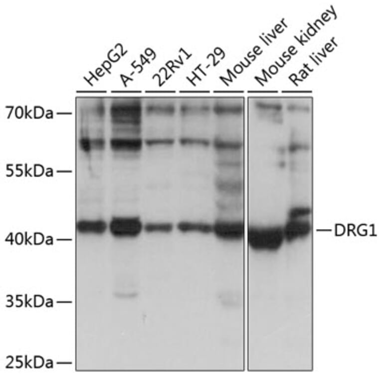 Western Blot - Anti-DRG1 Antibody (A14500) - Antibodies.com
