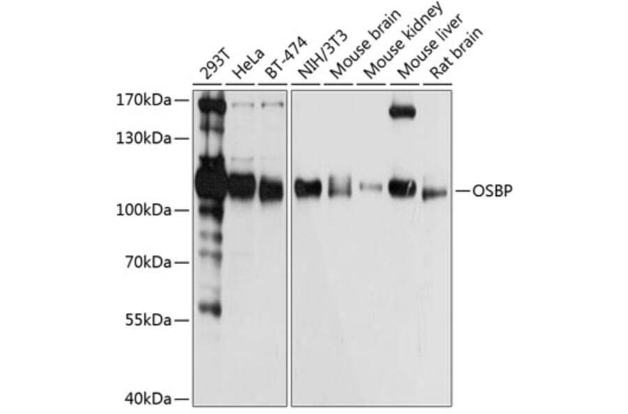 Western Blot - Anti-OSBP1 Antibody (A14501) - Antibodies.com