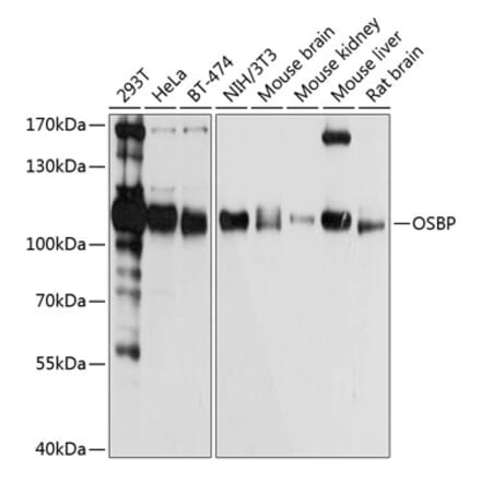 Western Blot - Anti-OSBP1 Antibody (A14501) - Antibodies.com