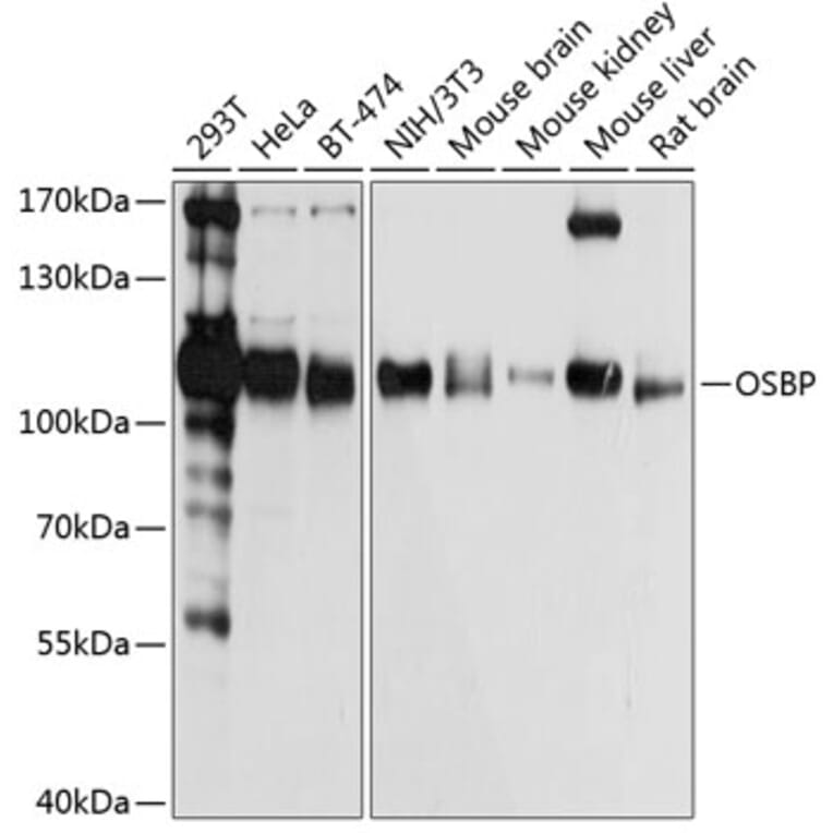 Western Blot - Anti-OSBP1 Antibody (A14501) - Antibodies.com