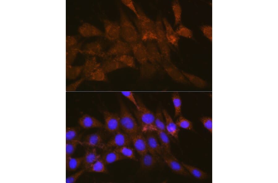 Immunofluorescence - Anti-OSBP1 Antibody (A14501) - Antibodies.com