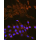 Immunofluorescence - Anti-OSBP1 Antibody (A14501) - Antibodies.com