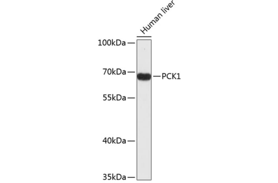 Western Blot - Anti-PCK1 Antibody (A4005) - Antibodies.com