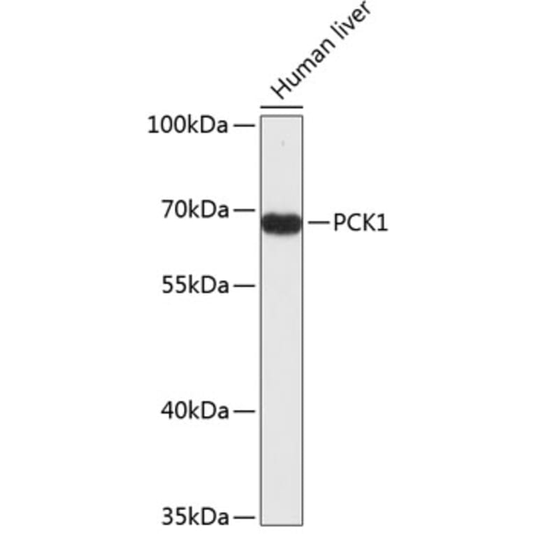 Western Blot - Anti-PCK1 Antibody (A4005) - Antibodies.com