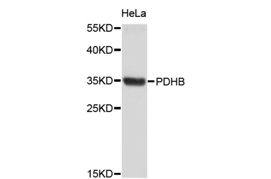 Western Blot - Anti-PDHB Antibody (A4011) - Antibodies.com