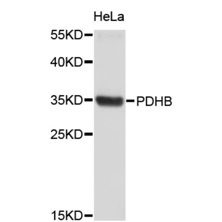 Western Blot - Anti-PDHB Antibody (A4011) - Antibodies.com
