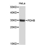 Western Blot - Anti-PDHB Antibody (A4011) - Antibodies.com