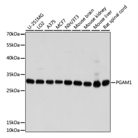Western Blot - Anti-PGAM1 Antibody (A14506) - Antibodies.com