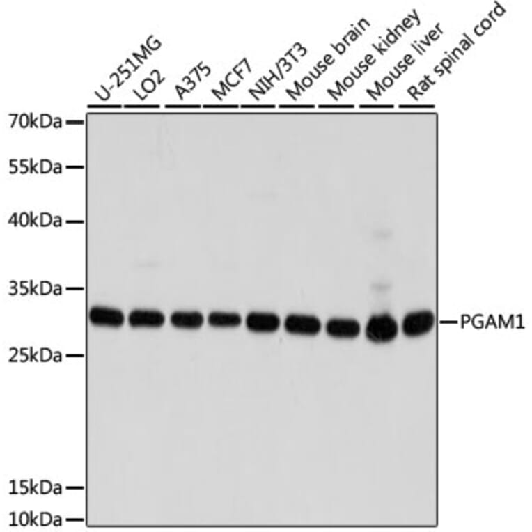 Western Blot - Anti-PGAM1 Antibody (A14506) - Antibodies.com