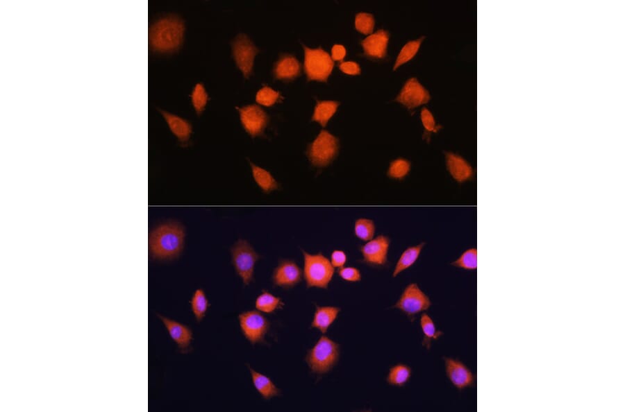 Immunofluorescence - Anti-PGAM1 Antibody (A14506) - Antibodies.com