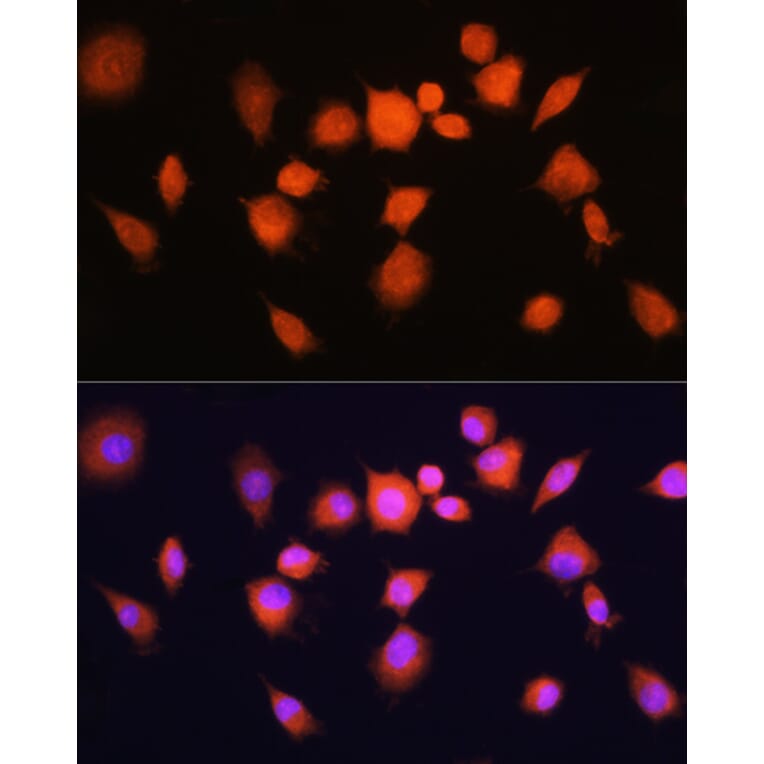 Immunofluorescence - Anti-PGAM1 Antibody (A14506) - Antibodies.com