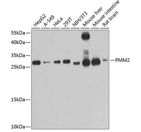 Western Blot - Anti-PMM2 Antibody (A14507) - Antibodies.com