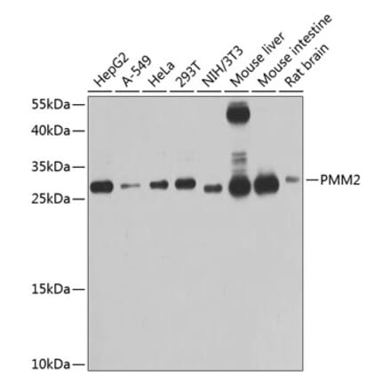 Western Blot - Anti-PMM2 Antibody (A14507) - Antibodies.com