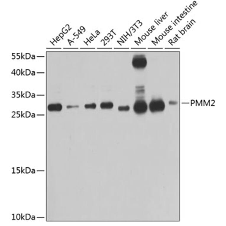 Western Blot - Anti-PMM2 Antibody (A4026) - Antibodies.com