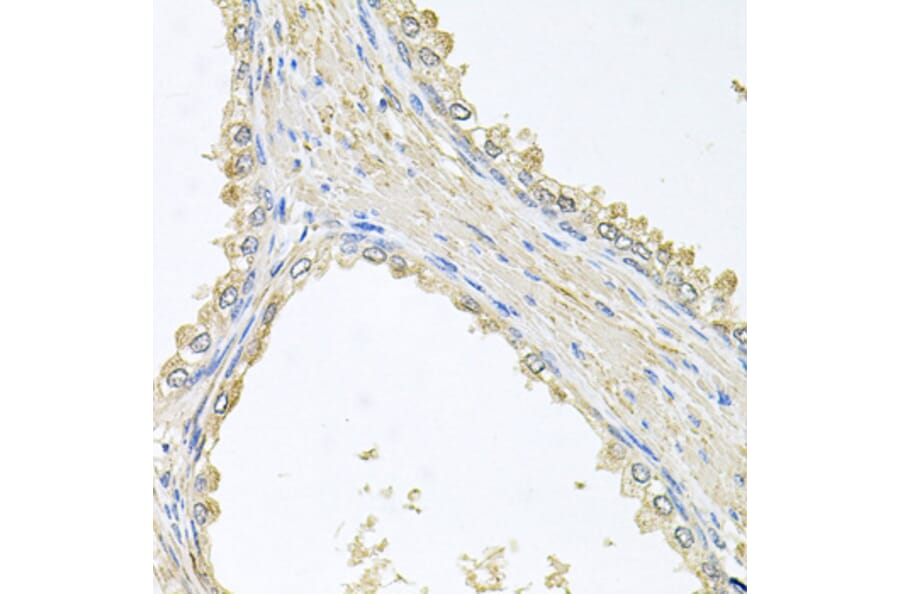 Immunohistochemistry - Anti-PMM2 Antibody (A4026) - Antibodies.com
