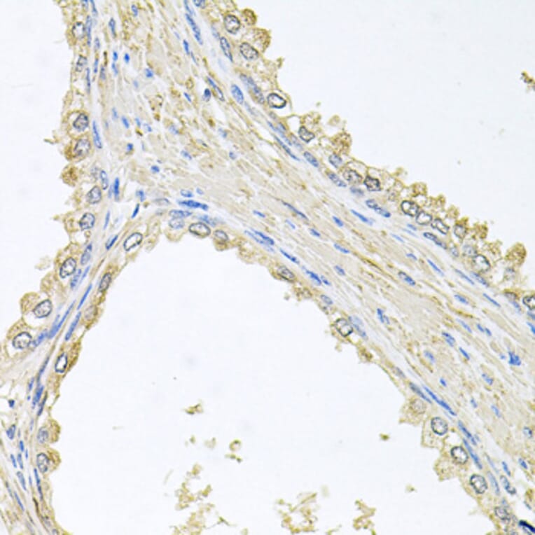 Immunohistochemistry - Anti-PMM2 Antibody (A4026) - Antibodies.com