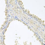 Immunohistochemistry - Anti-PMM2 Antibody (A4026) - Antibodies.com