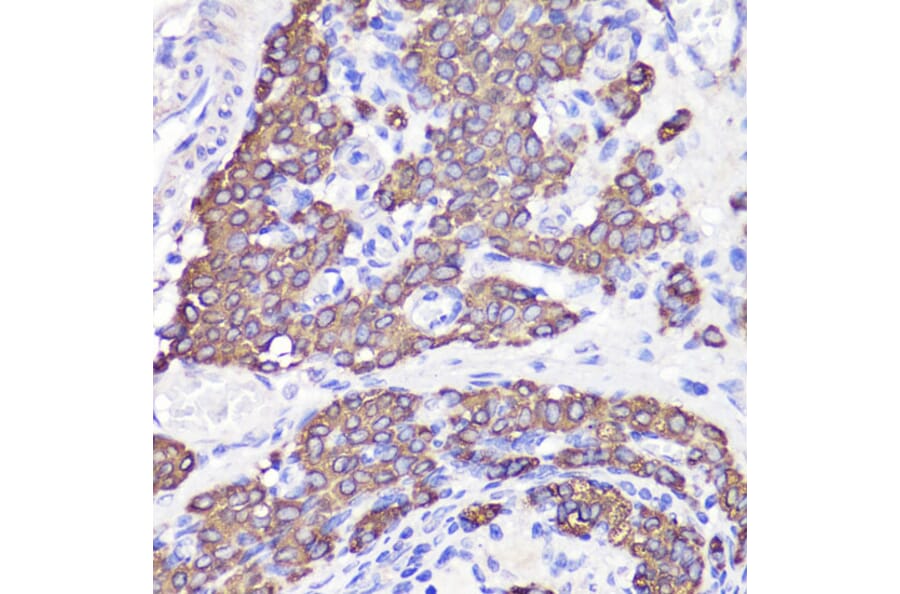 Immunohistochemistry - Anti-UBL3 Antibody (A14508) - Antibodies.com