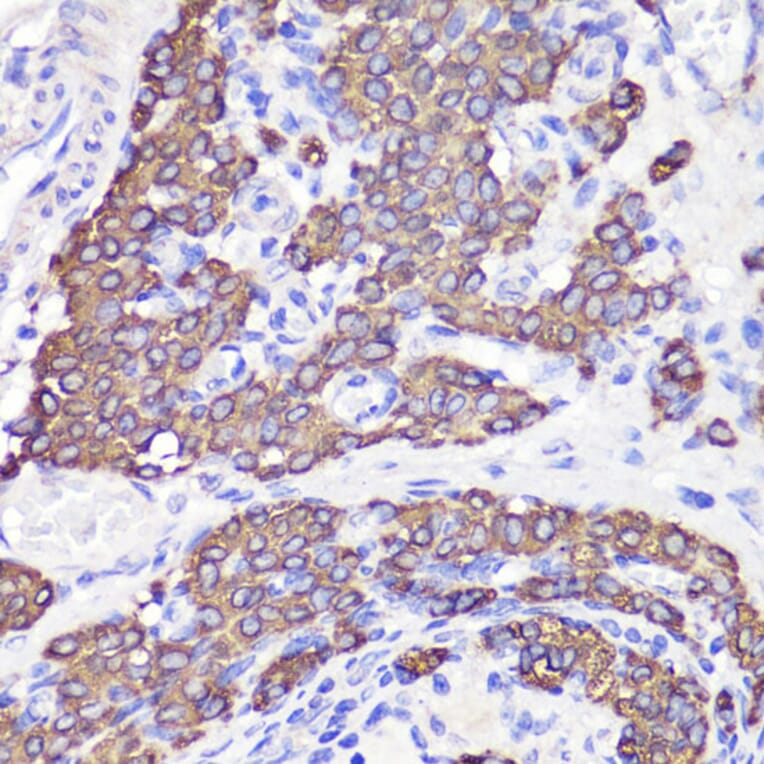 Immunohistochemistry - Anti-UBL3 Antibody (A14508) - Antibodies.com
