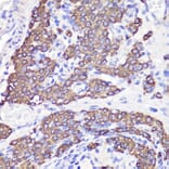 Immunohistochemistry - Anti-UBL3 Antibody (A14508) - Antibodies.com