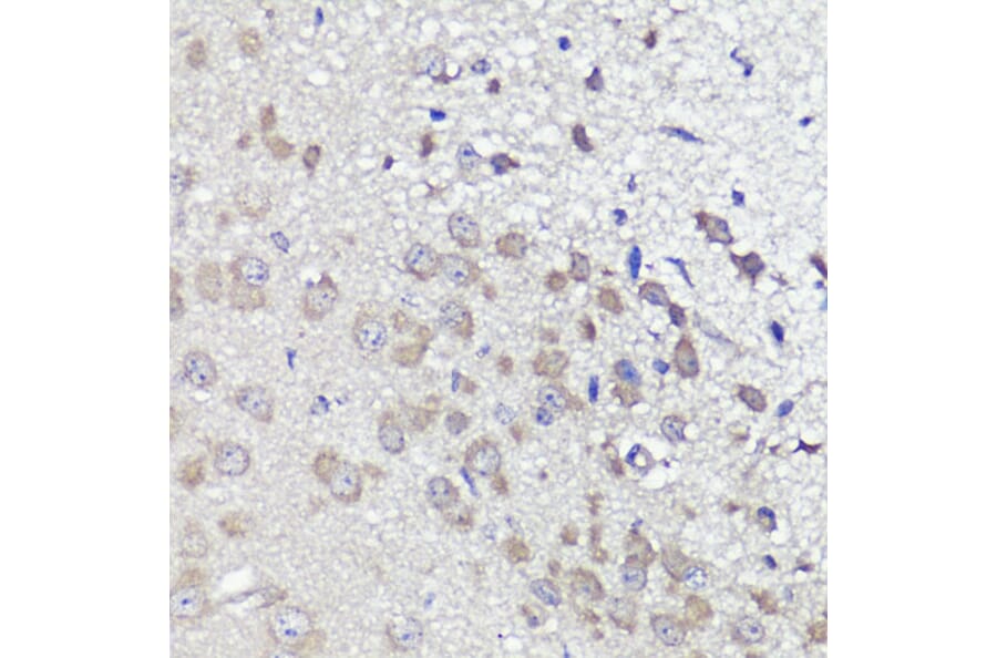 Immunohistochemistry - Anti-UBL3 Antibody (A14508) - Antibodies.com