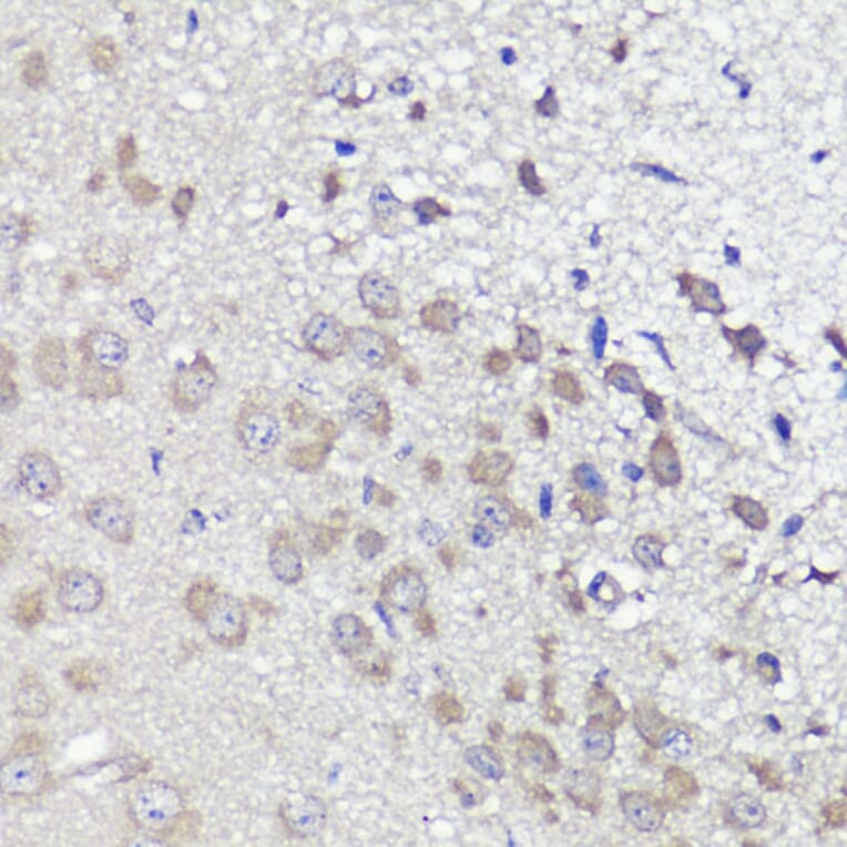Immunohistochemistry - Anti-UBL3 Antibody (A14508) - Antibodies.com
