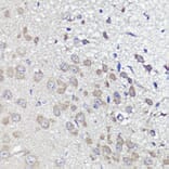Immunohistochemistry - Anti-UBL3 Antibody (A14508) - Antibodies.com