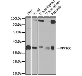 Western Blot - Anti-PP1C gamma Antibody (A14509) - Antibodies.com
