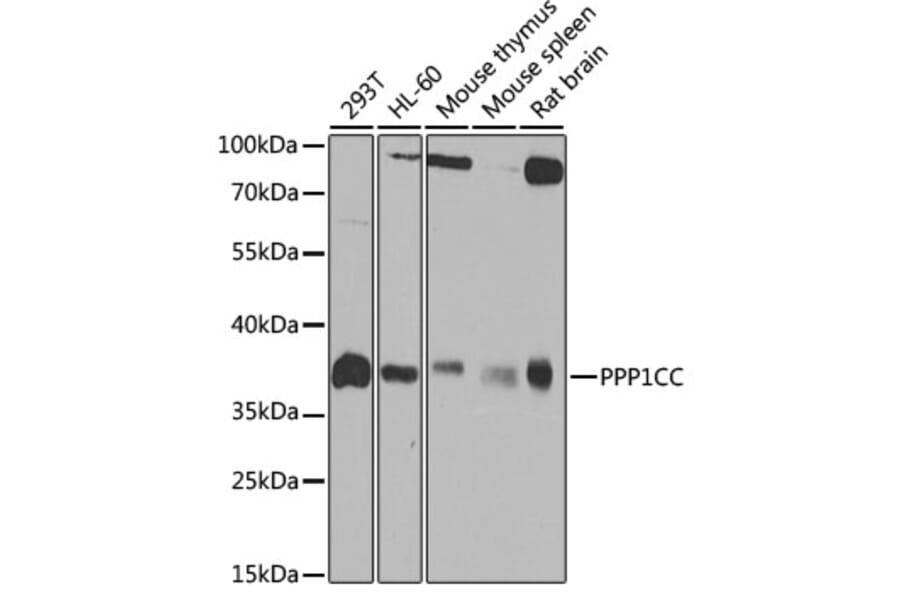 Western Blot - Anti-PP1C gamma Antibody (A14509) - Antibodies.com