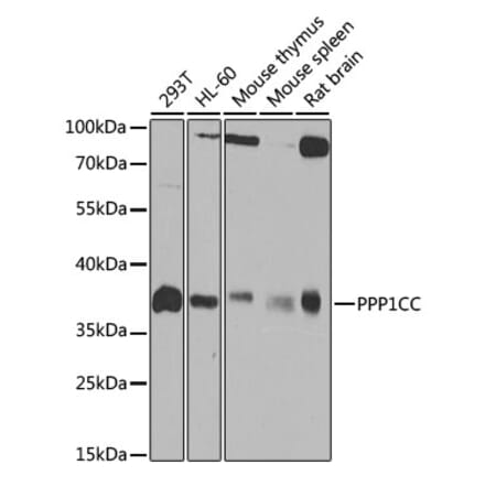 Western Blot - Anti-PP1C gamma Antibody (A14509) - Antibodies.com